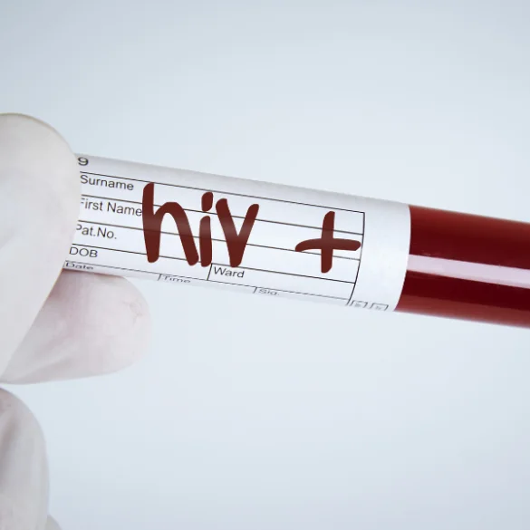 Hiv aids com infeccoes oportunistas ou neuropatias graves