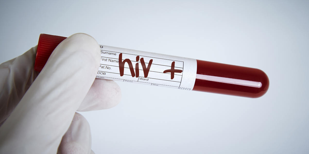 Hiv aids com infeccoes oportunistas ou neuropatias graves